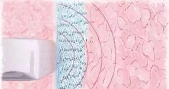 640_wx_fmt=jpeg&wxfrom=5&wx_lazy=1&wx_co=1 (1).jpg