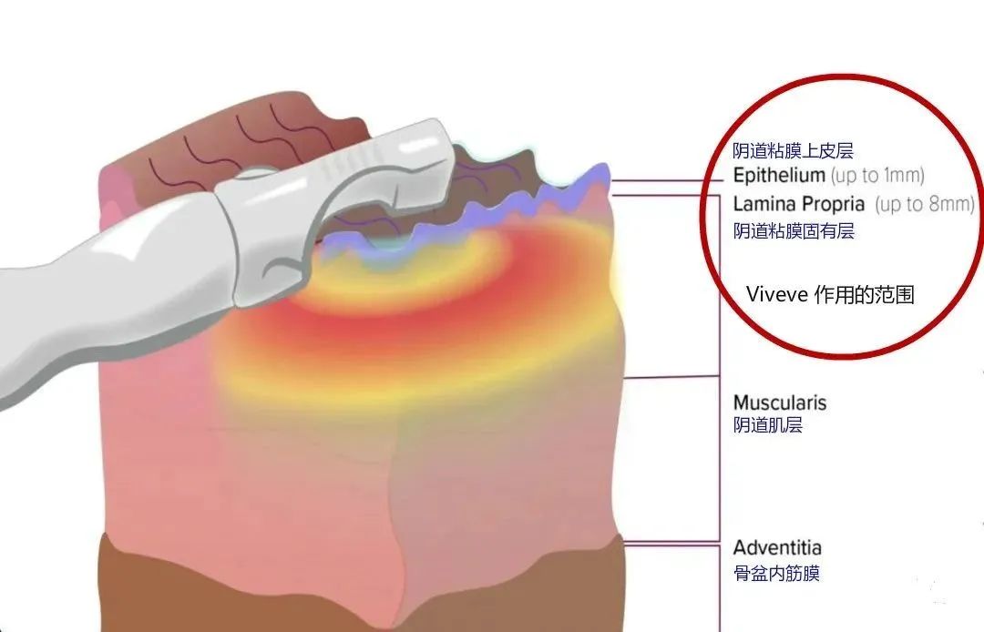 640_wx_fmt=jpeg&wxfrom=5&wx_lazy=1&wx_co=1 (2).jpg