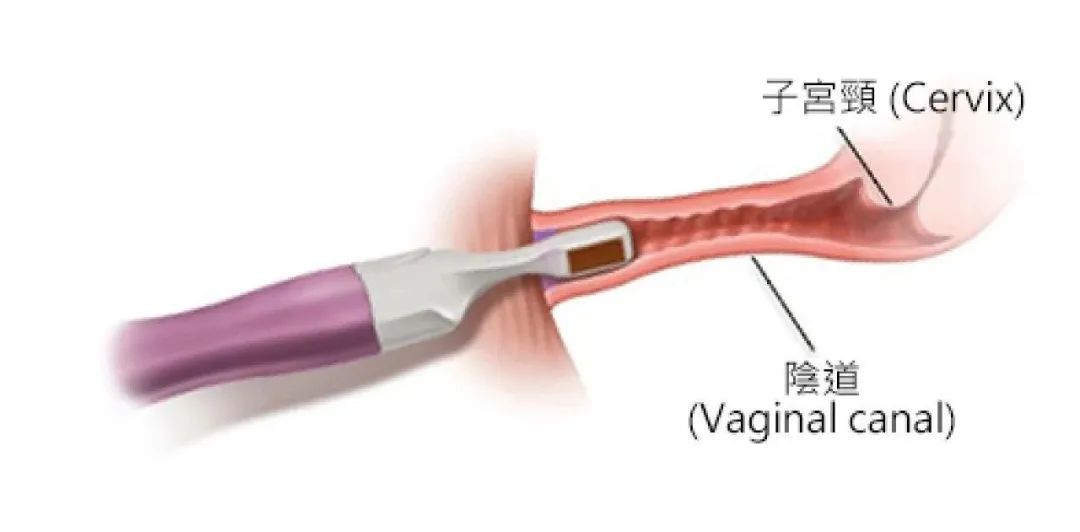 640_wx_fmt=jpeg&wxfrom=5&wx_lazy=1&wx_co=1 (3).jpg