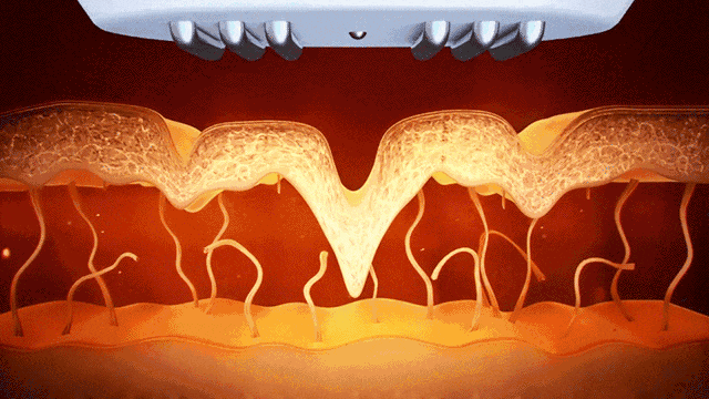 640_wx_fmt=gif&wxfrom=5&wx_lazy=1 (1).gif