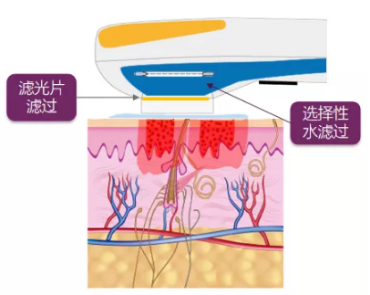 640_wx_fmt=png&from=appmsg&wxfrom=5&wx_lazy=1&wx_co=1 (8).png