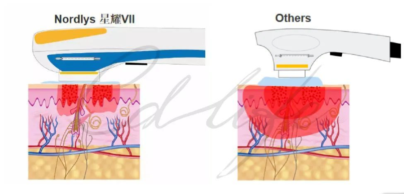640_wx_fmt=png&from=appmsg&wxfrom=5&wx_lazy=1&wx_co=1 (12).png