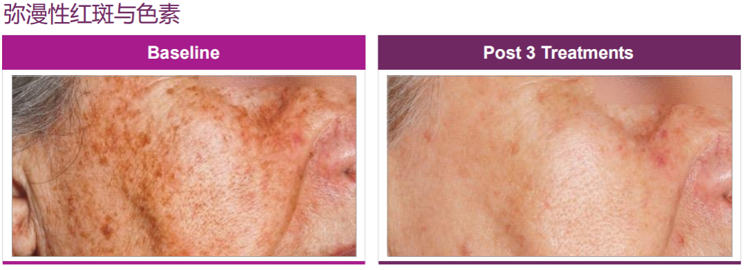 640_wx_fmt=png&from=appmsg&wxfrom=5&wx_lazy=1&wx_co=1 (15).png