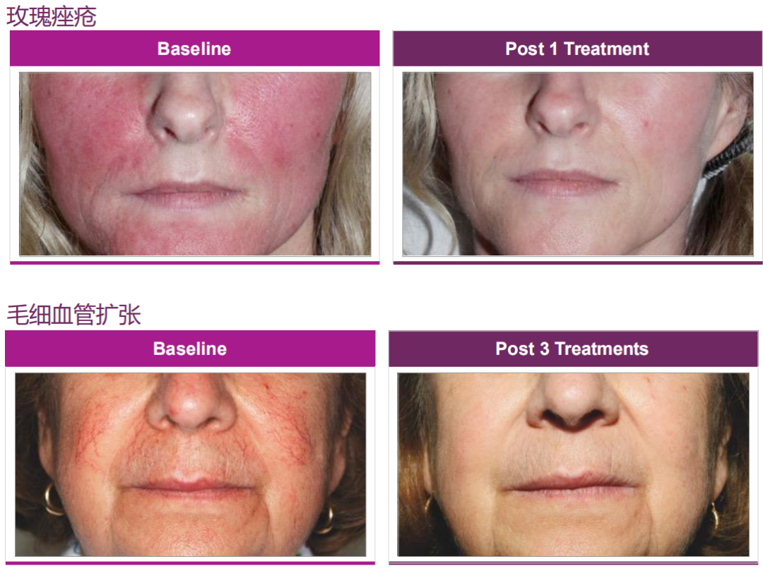 640_wx_fmt=png&from=appmsg&wxfrom=5&wx_lazy=1&wx_co=1 (14).png