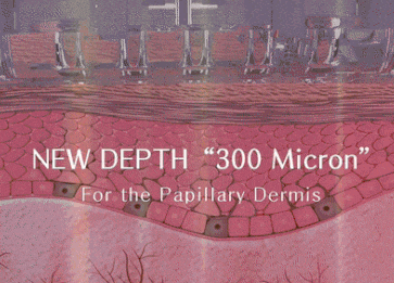 640_wx_fmt=gif&from=appmsg&wxfrom=5&wx_lazy=1 (1).gif