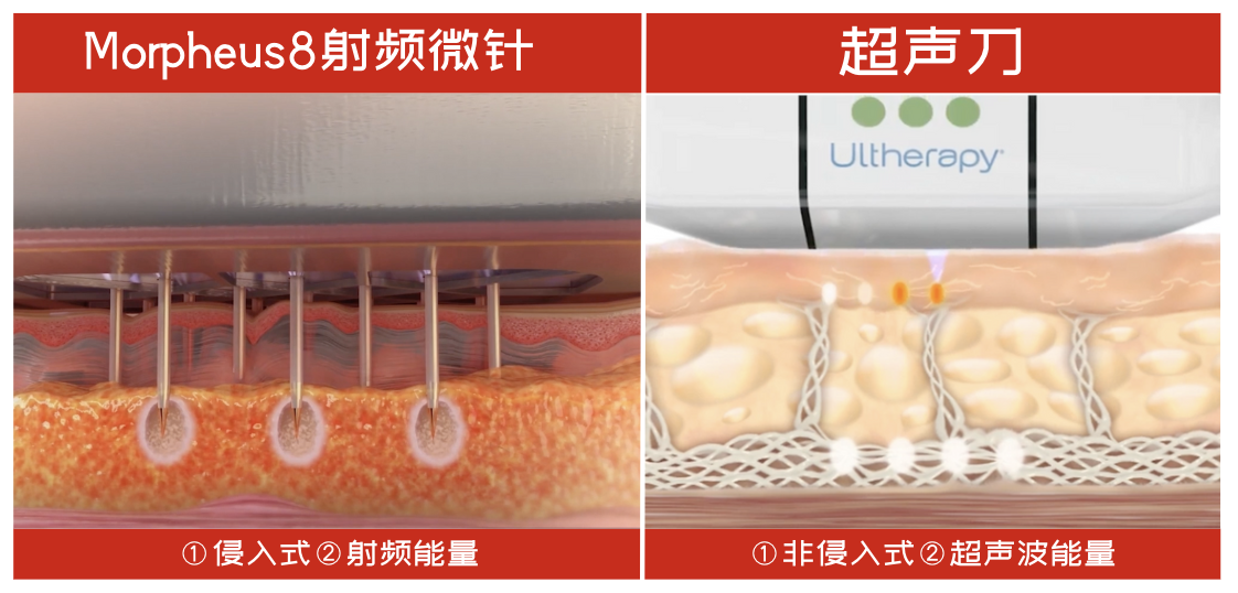 微信图片_20240411095812.png